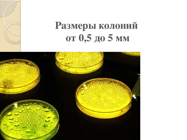размер колонии. размер колоний микроорганизмов. характеристика s и r форм колоний. формы колоний бактерий микробиология. размер колоний э.